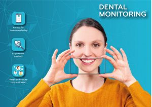 Dental Monitoring