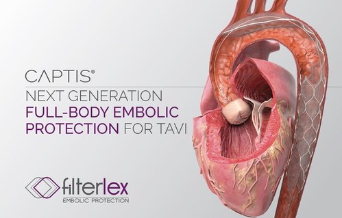The CAPTIS is a next-generation, full-body embolic protection device to reduce the risk of stroke and other complications during left-heart procedures.