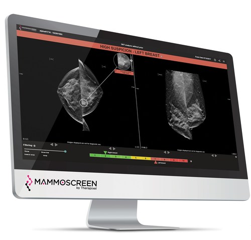 Mammoscreen